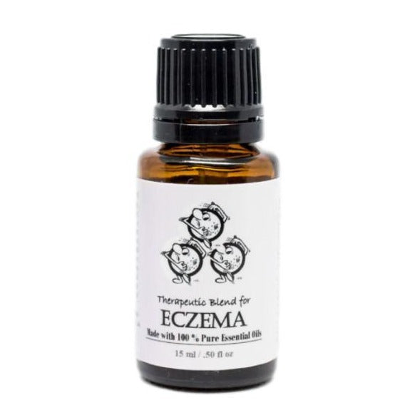 
                
                    Load image into Gallery viewer, Eczema Blend 15ml
                
            